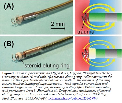 Cardiac Pacemaker