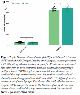 Fig. 2A